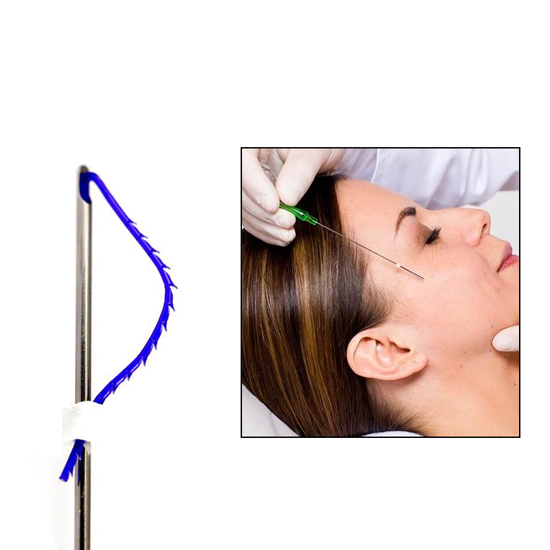 PDO Cog 3D Thread for Face Lift - Image 5