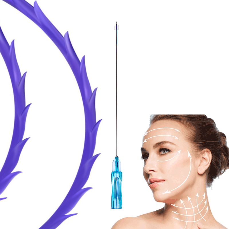 PDO Cog 3D Thread for Face Lift - Image 3